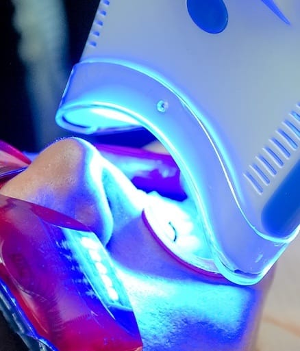 Patient receiving in office teeth whitening treatment