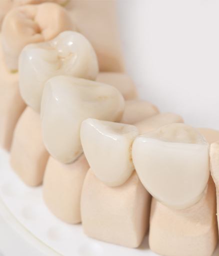Model smile with row of dental crowns