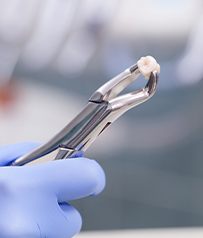 Metal clasp holding wisdom tooth after extraction
