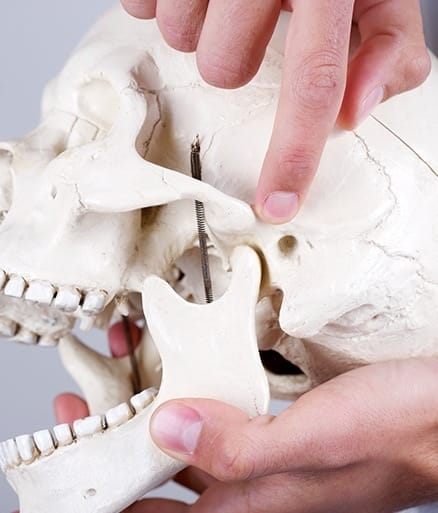 Model of jaw skull bone used for sleep apnea treatment planning