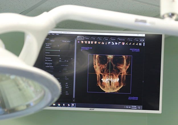 3 D  digital x-ray scans used for T M J therapy planning
