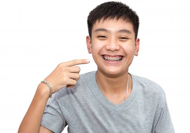 Teen with traditional braces pointing at his smile