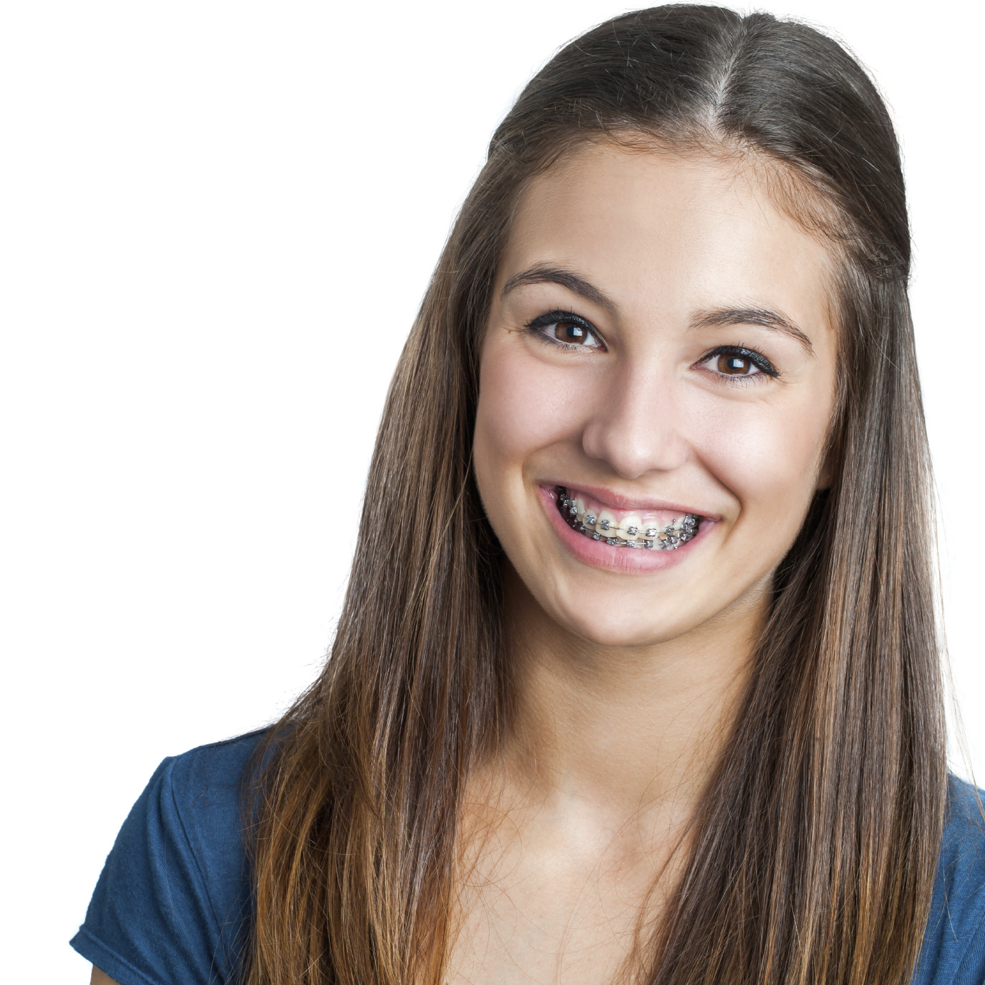 Straight Teeth are Really Possible at Complete Cosmetic Care Dentistry! -  918 Dentist Blog